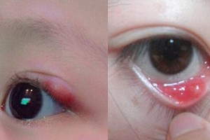 （示意圖源：互聯網） 