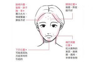 青春痘長在哪，看出你的身體警訊！