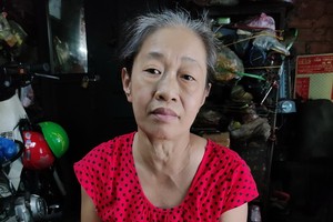 陳枝梅患上腎衰竭，手臂浮腫。