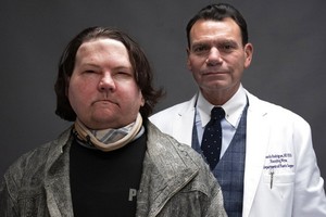 迪梅奧（左）在醫生羅德里格斯的幫助下獲得新生。（圖源：AP）