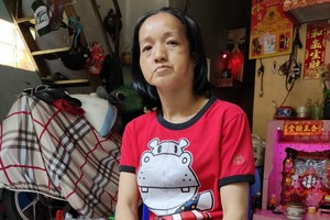 鄒月女的腫塊變大又痛，導致她呼吸、說話都很困難。