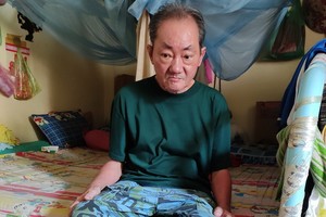 張朝傑雙眼視力模糊，雙腳浮腫，行動不便。