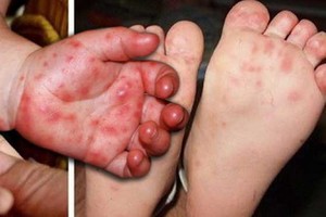 （示意圖源：互聯網） 