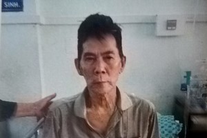 姜凱姜要隨身攜帶尿袋。