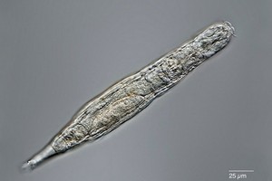 俄羅斯科學家成功喚醒的“蛭形輪蟲”。（圖源：互聯網）