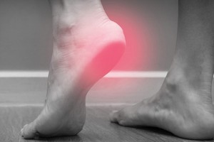 腳跟痛不一定是足底筋膜炎！