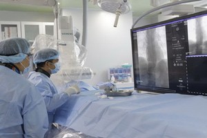 芹苴心血管中風醫院的中風干涉病例。