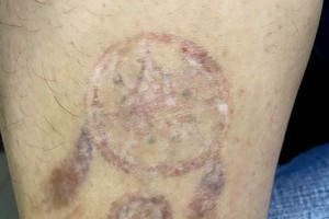 不少學生盲目紋身，之後懊悔不已。