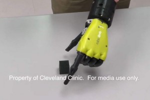 新研發仿生手臂可與佩戴者的大腦進行交流