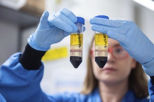 世界衛生組織歐洲區主任克魯格表示，變種病毒的出現已令群體免疫的希望“破滅”。（示意圖源: 互聯網）