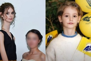 女子得奇病擁有 18 釐米超長“天鵝頸”