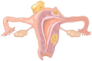卵巢“年齡”有多大？保養要注意４個階段