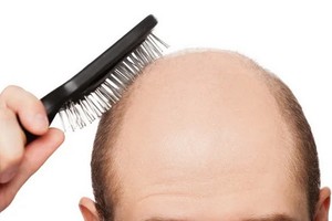 脫髮八問：生薑洗髮水能減少脫髮嗎？