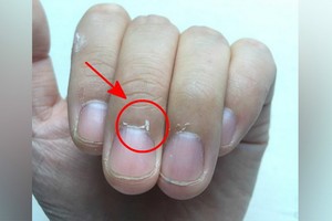 三個正確處理倒刺方法！