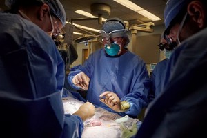 手術團隊。（圖源：視頻截圖）