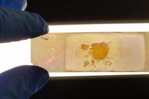 澳洲研發新型顯微鏡載玻片，可快速識別癌細胞。（圖源：互聯網）