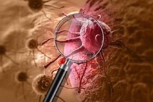 癌症真的會遺傳嗎？