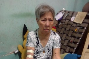 鄧氏環的腎衰竭愈發嚴重。