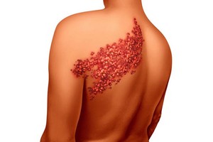 “纏腰龍”頭尾相接，真的會要命麼？