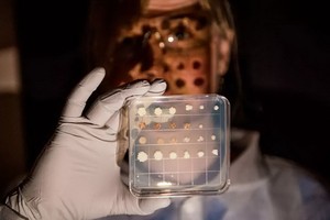 蓍果脂解酵母的不同培養基。