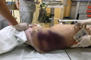 8歲女童在送達醫院前已死亡，身上多處瘀傷疑似受虐。（圖：院方提供）