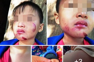 自2022年1月1日起，據《行政違規處理法》，對於有家庭暴力行為者（受害者是配偶、孩子、父母、兄弟姐妹、照顧者等），可以按行政手續暫扣。 