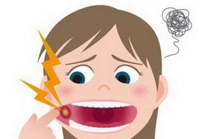 警惕這種口腔潰瘍