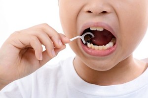孩子幾歲可以用牙線？