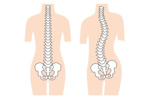 如何預防頸椎病？