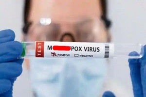 世界衛生組織28日宣佈“mpox”為猴痘的新名稱。（示意圖：互聯網）