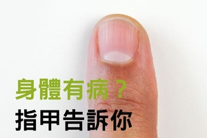 指甲月牙消失、有直线是器官生病？