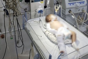 疑被虐待的女婴伤势十分严重，目前正在该医院儿科接受积极治疗。（图：VTT）