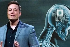 马斯克企业获准开展脑机连接人体试验。（示意图：互联网）