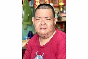 男青没有经费洗肾