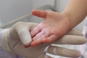 （示意图：互联网）