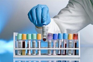 为什么去医院看病要抽血？