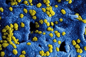 中东呼吸综合征冠状病毒数字影像。（图：美国国家过敏及传染性疾病研究所）