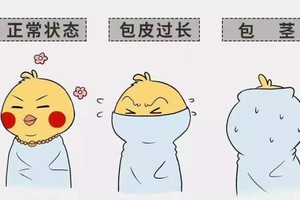 孩子做包皮手术注意事项