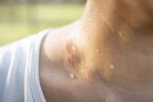 “这种汗”藏内脏警讯！