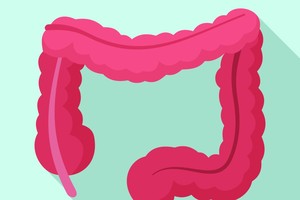 结肠镜检查知多少