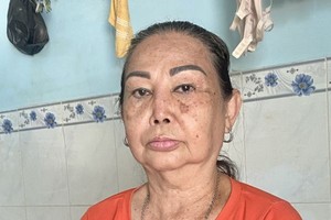 老妇患子宫期满出血症