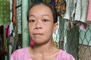 陈清香与她洗肾的手。