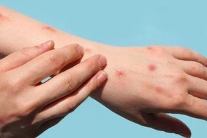 （示意图：互联网）