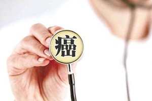 人工智能开发出“癌症生存计算器”