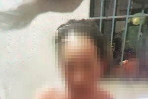 受害人目前正在医院接受治疗。（图：黎春）