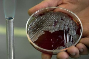 图为炭疽菌样本。（图：AP）