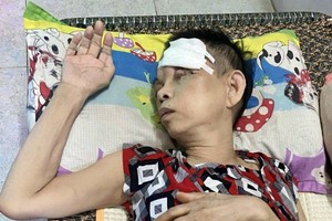 余惠娇的眼角被严重受伤。