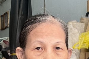 患乳癌老妇求助