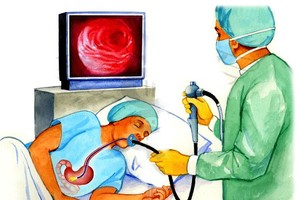 谁适合同时做肠胃镜检查？