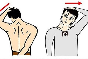 头痛又脖子卡卡恐是“颈源性头痛”惹祸